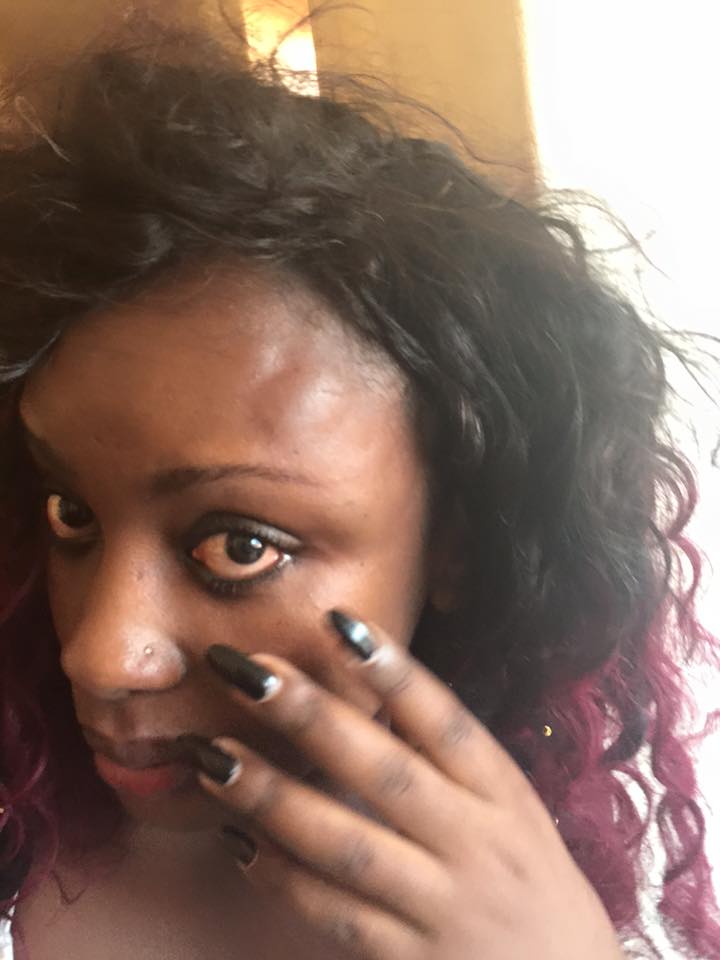 Leila Kayondo showing off swollen face